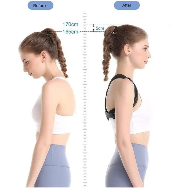 Velmesta Adjustable Posture Corrector